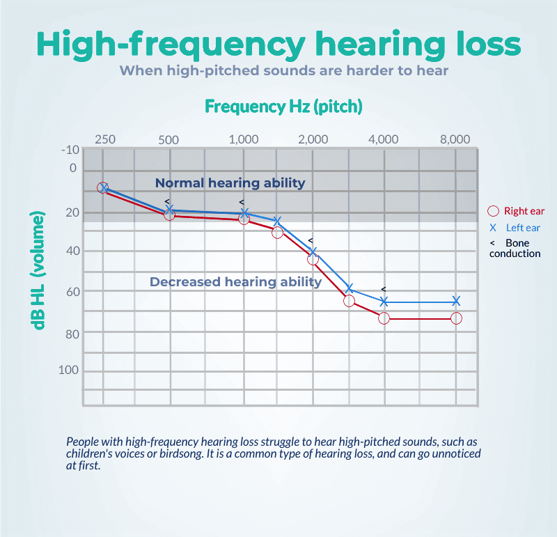 high-frequency hearing loss